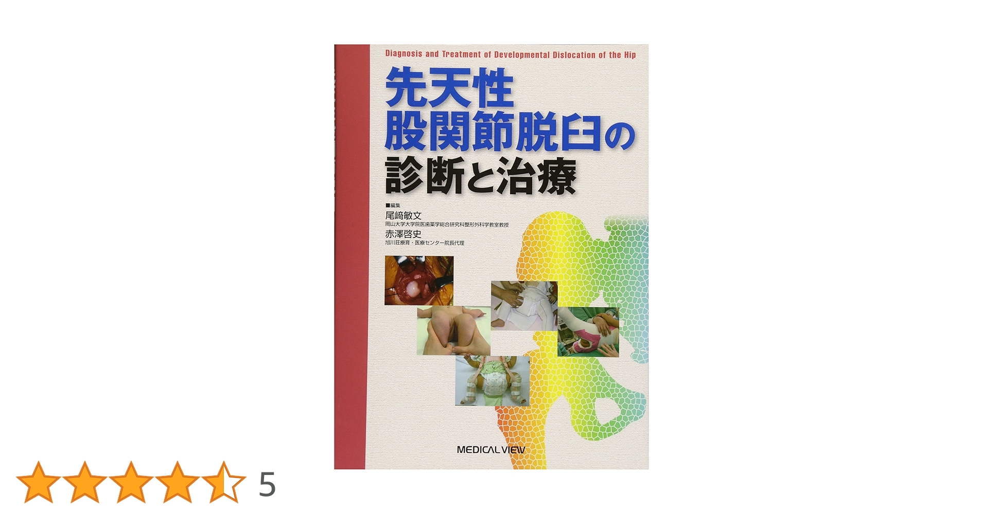 先天性股関節脱臼の診断と治療/メジカルビュ-社/尾崎敏文（単行本） メジカルビュー社｜整形外科｜先天性股関節脱臼の診断と治療